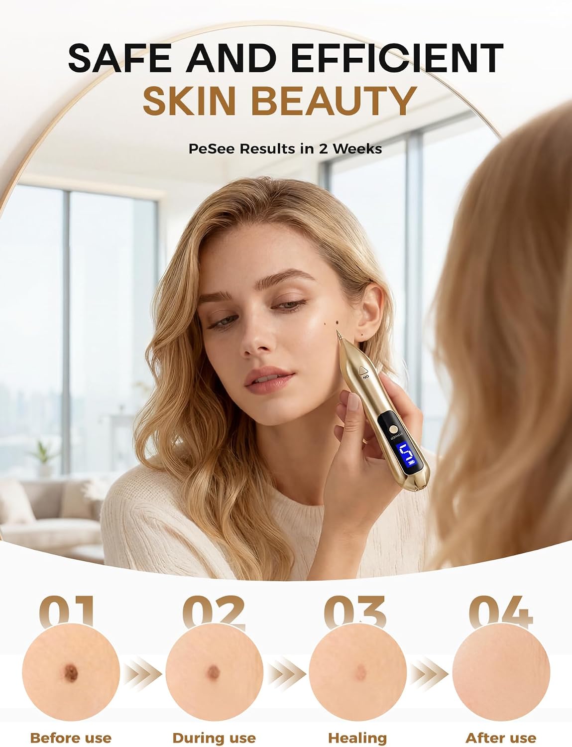 Releva™ Skin Tag & Mole Remover Pen