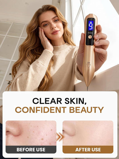 Releva™ Skin Tag & Mole Remover Pen